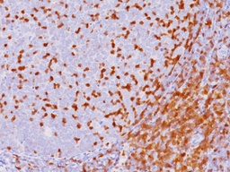 [ACI259A] ANTICUERPO MONOCLONAL ZAP-70 (LR), CLONA BC.2F3.2, ISOTIPO IgG2a, CONCENTRADO X 0.1 ML